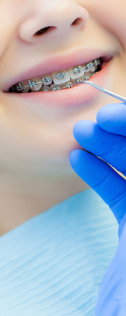 Orthodontiste contrôle un appareil dentaire à une adolescente.